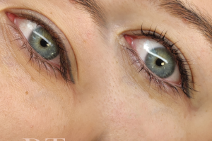 Lash 1