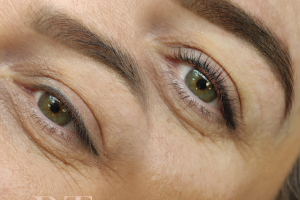 Lash 2