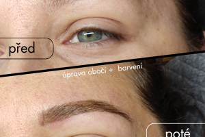 Pred Po Browbar